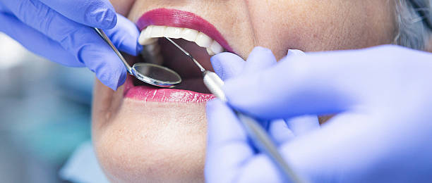 Best Emergency Dental Care for Broken or Chipped Teeth in Ladd, IL